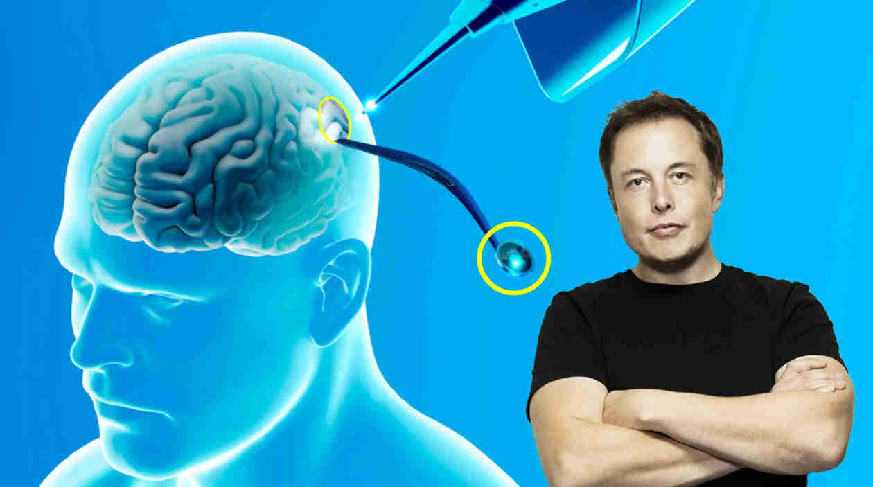 l multimillonario tecnológico Elon Musk anunció un importante avance en su empresa Neuralink, al afirmar que han realizado con éxito el primer implante de uno de sus chips cerebrales inalámbricos en un ser humano.